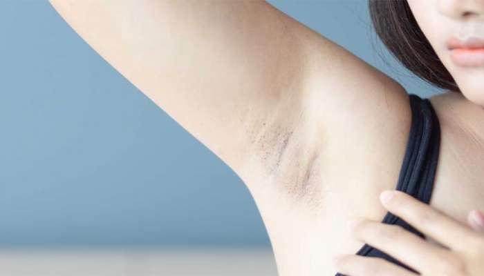 Skin Care Tips: અંડરઆર્મ્સની કાળાશ દુર કરવા આ રીતે કરો લીંબુનો ઉપયોગ
