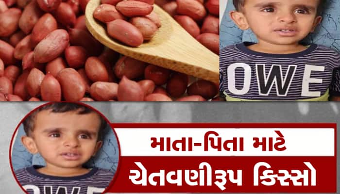 આ ઘટના તમને વિચલિત કરી દેશે, એક મહિના બાદ બાળકના ગળામાંથી નીકળ્યો સીંગદાણો