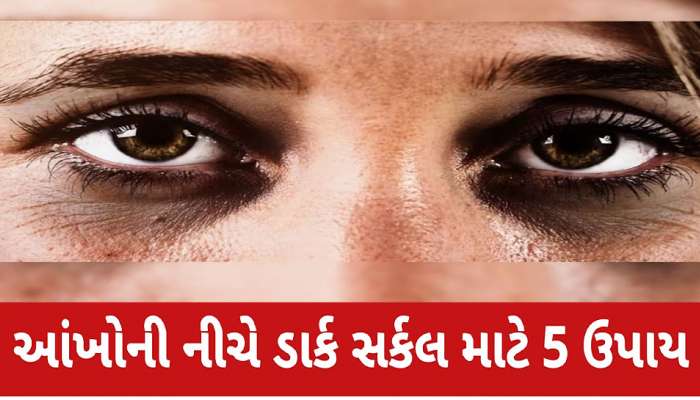 Dark Circle: આંખોની નીચે થયા છે કાળા કુંડાળા? તો અજમાવો આ સરળ ઉપાય