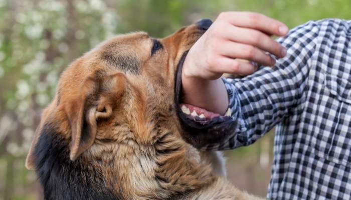 What To Do On Dog Bite: જો કૂતરુ કરડે તો પહેલા શું કરવું જોઈએ? એક્સપર્ટ પાસેથી જાણો ઉપચાર