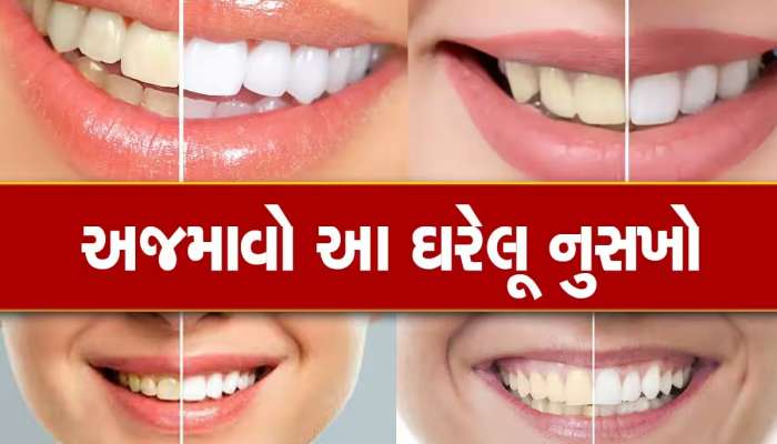 ડેન્ટિસ્ટનો ખર્ચ બચાવવા માંગો છો? તો આ 5 ટ્રિક્સથી દાંતની પીળાશ કરો દૂર