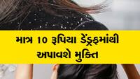 ખૂબ રૂપિયા વેડફ્યા પછી પણ ડેંડ્રફની સમસ્યા દૂર ન થતી હોય તો અપનાવો આ ઘરેલૂ નુસખા