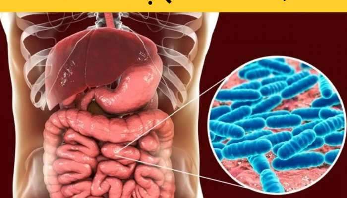 Unhealthy Gut: શું તમારા આંતરડામાં કીડા પડવા લાગ્યા છે? આ સંકેતોને અવગણશો નહીં