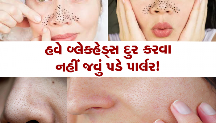 ફ્રીજમાં રાખેલી 2 વસ્તુઓ દૂર કરશે જીદ્દી બ્લેકહેડ્સ, આજે જ અજમાવો આ ઘરગથ્થુ નુસ્ખો