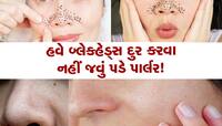 ફ્રીજમાં રાખેલી 2 વસ્તુઓ દૂર કરશે જીદ્દી બ્લેકહેડ્સ, આજે જ અજમાવો આ ઘરગથ્થુ નુસ્ખો