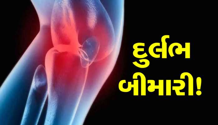 ટોઈલેટ સીટ પર બેસતા જ મહિલાનું ઘૂંટણનું હાડકું તૂટ્યું, કારણ જાણી દંગ રહી જશો