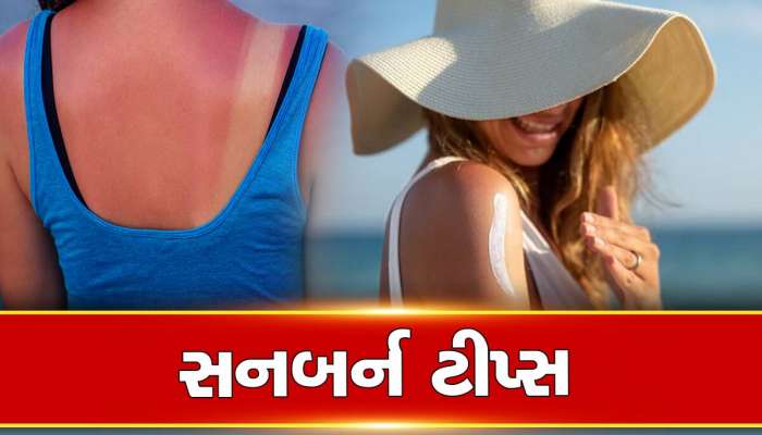 Natural sunscreen: સનબર્નથી બચવા ઘરમાં રહેલ આ 5 વસ્તુનો કરો ઉપયોગ, ત્વચા રહેશે ડેમેજ ફ્રી