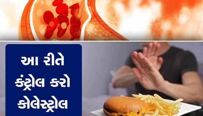 આ 4 વસ્તુઓને ડાયટમાંથી તરત જ કરી દો આઉટ, એક જ મહિનામાં ઘટી જશે કોલેસ્ટ્રોલ