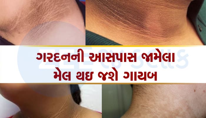 Black Neck: ફક્ત 15 મિનિટ સાફ થઇ જશે તમારી કાળી ગરદન, આ ઉપાયોથી મળશે જોરદાર રિઝલ્ટ