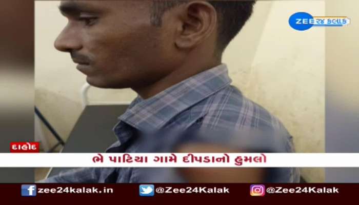 Dahod: ભે પાટિયા ગામે દીપડાએ ઘર બહાર સુતેલા પરિવાર પર કર્યો હુમલો 