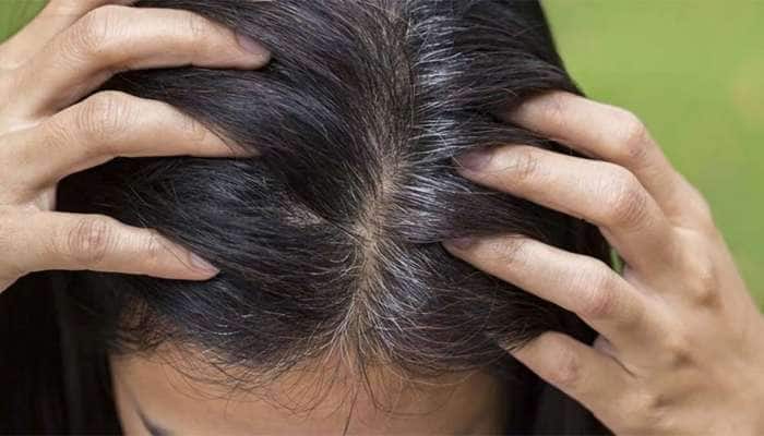 Hair Care: 30 પહેલા વાળ થવા લાગ્યા હોય સફેદ તો જાણો વાળને કાળા કરવાનો કુદરતી ઉપાય