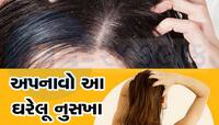 માનો કે ન માનો 10 રૂપિયાનો સિક્કો દૂર કરશે ડેંડ્રફ, મોંઘીદાટ પ્રોડક્ટનો થશે મોહભંગ