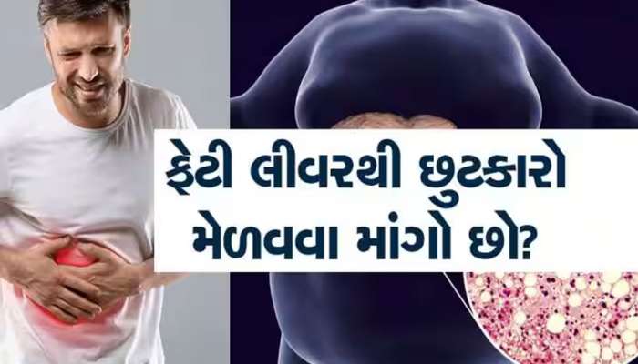 LIVER DISEASE: લીવરને બચાવવું હોય તો આજથી જ લાઈફ સ્ટાઈલમાં કરો આ પરિવર્તન