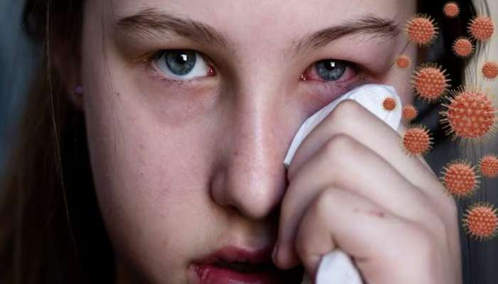 Eye Infection: ચોમાસામાં આંખની સંભાળ રાખવા ફોલો કરો આ સરળ ટીપ્સ, નહીં થાય આંખની બીમારી 
