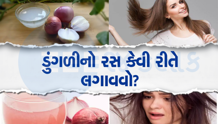 Hair Care Tips: શું ડુંગળીના રસને સ્કૈલ્પ પર લગાવવાથી નુકસાન થાય છે? જાણો કેવી રીતે લગાવશો
