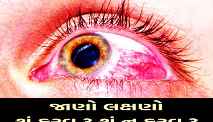 CHILD EYE FLU: બાળકોમાં તેજીથી ફેલાઈ રહ્યો છે Eye Flu, જાણો આઈ ફ્લૂના લક્ષણો અને તેના ઉપચાર