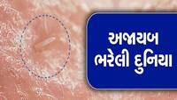 માણસોના સૂઈ ગયા બાદ માણસના ચહેરા પર સંભોગ કરે છે આ કીડા, કરી શકે છે તમને બિમાર