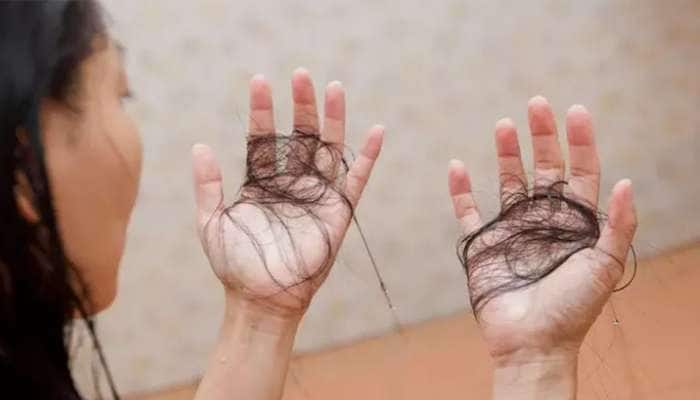 Hair Care: ચોમાસામાં વધી જતી ખરતા વાળની સમસ્યા દુર કરશે આ ઘરેલુ ઉપાય