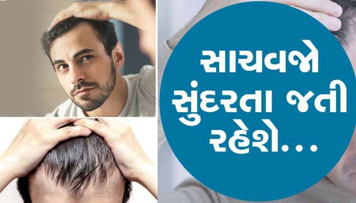 30 દિવસમાં ટાલમાં પણ દેખાવા લાગશે વાળ, ટ્રાય કરો આમાંથી કોઈપણ એક દેશી ઉપાય
