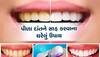 Teeth Whitening: પીળા દાંત સફેદ કરવાના 3 ઘરગથ્થુ ઉપાય, બસ આટલું કરવાથી મોતીની જેમ ચમકવા લાગશે 