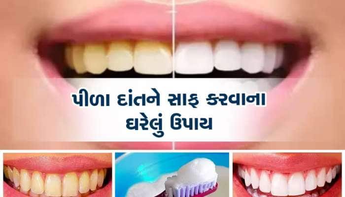 Teeth Whitening: પીળા દાંત સફેદ કરવાના 3 ઘરગથ્થુ ઉપાય, બસ આટલું કરવાથી મોતીની જેમ ચમ