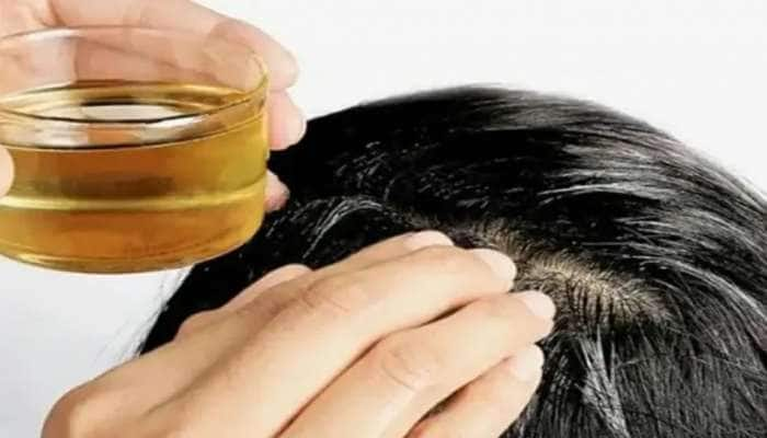 Hair Fall Control: ચોમાસામાં વાળને ખરતા અટકાવશે આ 5 હેર ઓઈલ, ઝડપથી વધે છે વાળ 