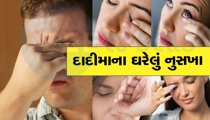 Itchy Eyes: આંખોને વારંવાર મસળવાથી થાય છે આ નુકસાન, ઘરેલુ વસ્તુઓથી દૂર કરો ઇચિંગ