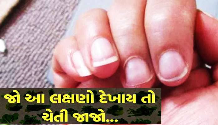 Protein: શરીરમાં પ્રોટીનની કમી હશે તો દેખાશે આવા સંકેતો, ઈગ્નોર કરવાની ના કરતા ભૂલ
