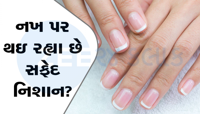 health Tips: નખ ખોલશે તમારા સ્વાસ્થ્યનું રહસ્ય, નખ પર આવા નિશાન દેખાય તો ચેતી જજો