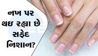 health Tips: નખ ખોલશે તમારા સ્વાસ્થ્યનું રહસ્ય, નખ પર આવા નિશાન દેખાય તો ચેતી જજો
