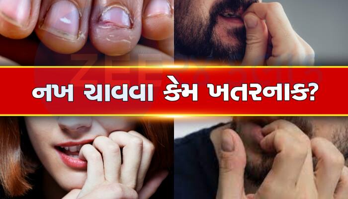 નખ ચાવવાની Bad Habit હોય તો સુધારી દેજો, નહીંતર થશે આ નુકસાન