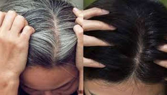 White Hair Solution: રોજની ડાયટમાં આ વસ્તુઓનો કરશો સમાવેશ તો અટકશે સફેદ વાળનો ગ્રોથ