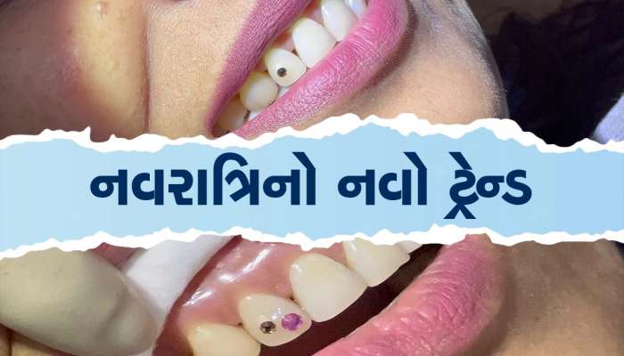 સુરતના ખેલૈયાઓમાં અનોખો ટ્રેન્ડ, આ વર્ષે દાંતમાં ડાયમંડ લગાવી ગરબે રમશે યુવતીઓ