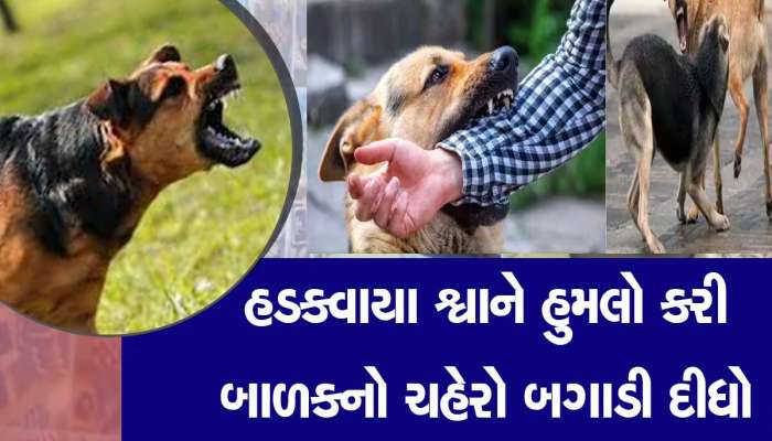 સુરતમાં ઘર પાસે રમી રહેલ બાળક પર શ્વાનને હુમલો કરી માથું કરડી ખાધું, બાળકને હોસ્પિટલમાં ખસેડાયો