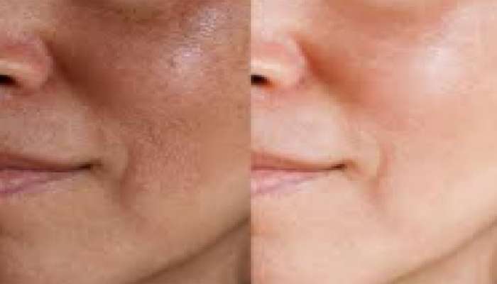 Skin Care: ચહેરા પર વધી ગઈ હોય ડેડ સ્કીન તો આ રીતે કરો લીંબુ અને મીઠાનો ઉપયોગ, 10 મિનિટમાં ચમકી જશે ત્વચા