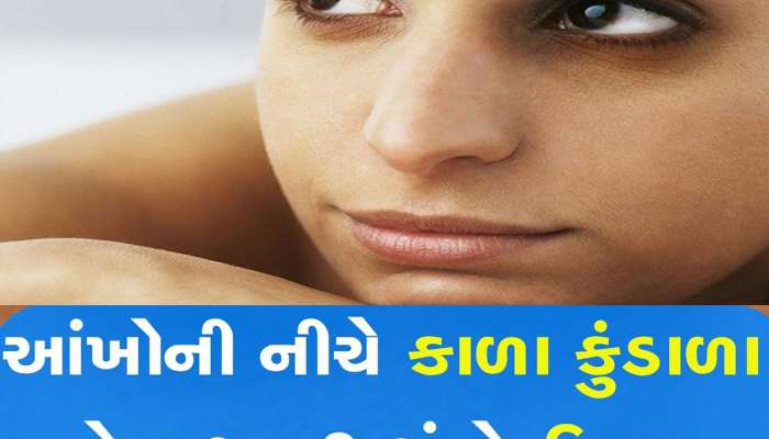આંખો નીચે થઈ ગયા છે કાળા કુંડાળા? ફિકર નોટ, આ ટિપ્સથી થઈ જશે સમસ્યાનું સમાધાન