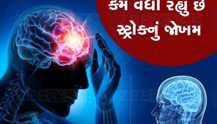 સ્ટ્રોકથી દર 4 મિનિટે એક ભારતીય નું મૃત્યુ થાય છે, સ્ટ્રોકથી બચવા આટલું રાખો ધ્યાન