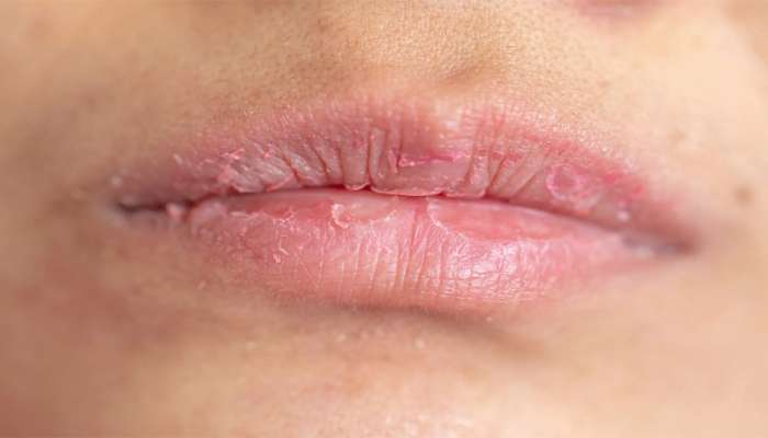 Beauty Tips: શિયાળામાં નહીં ફાટે હોઠ, એડી અને સ્કીન, અજમાવી જુઓ આ ઘરેલુ ઉપાય