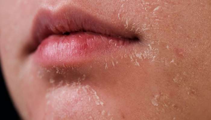 Skin Care: શિયાળામાં નહીં સતાવે ડ્રાય સ્કીનની સમસ્યા, નિયમિત લેવાનું રાખો આ વિટામિન્સ