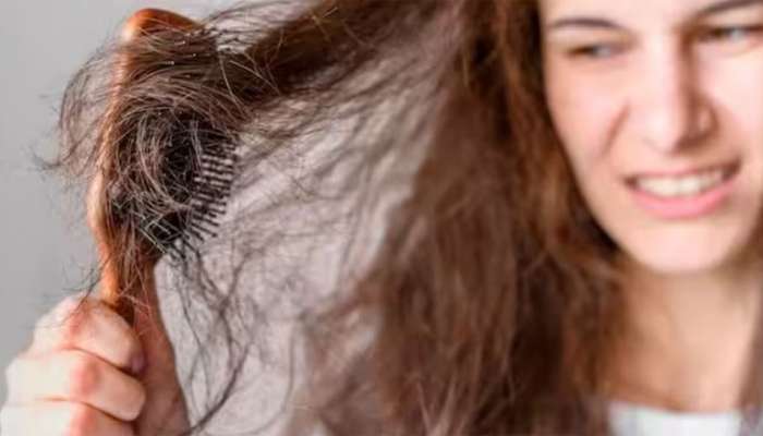 Hair Care Tips: વાળની ડ્રાયનેસથી તમે પણ છો પરેશાન? તો આ વસ્તુનો કરો ઉપયોગ, એકવારમાં જ વાળ થશે સોફ્ટ અને શાઈની