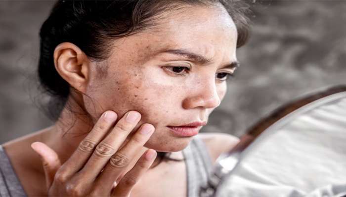 Skin Care: 4 ગંભીર બીમારીના સંકેત દેખાય છે ત્વચા પર, જોવા મળે તો સમજી લેજો તમે છો બીમાર
