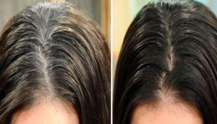 White Hair: આ વસ્તુનો ઉપયોગ કરી સફેદ વાળને મૂળમાંથી કરો કાળા, 50 વર્ષે પણ દેખાશો યંગ