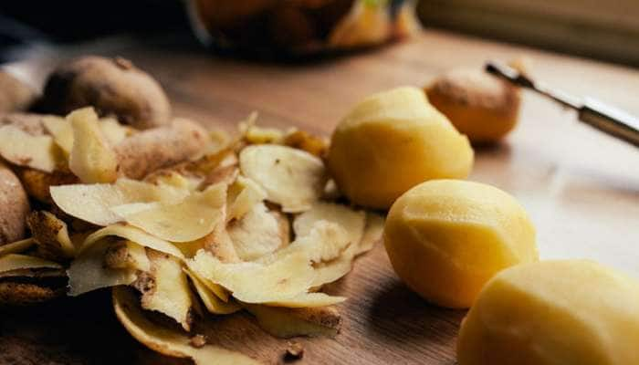 Potato Peels: કચરો સમજી ફેંકી ના દેતા બટેટાની છાલ, ઘણી બીમારીઓની છે આ દવા