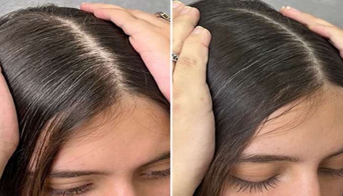 Hair Care: વિટામિનની ખામીથી પાતળા થયેલા વાળનો ગ્રોથ વધારવા અપનાવો આ 4 ઘરેલુ ઉપાય