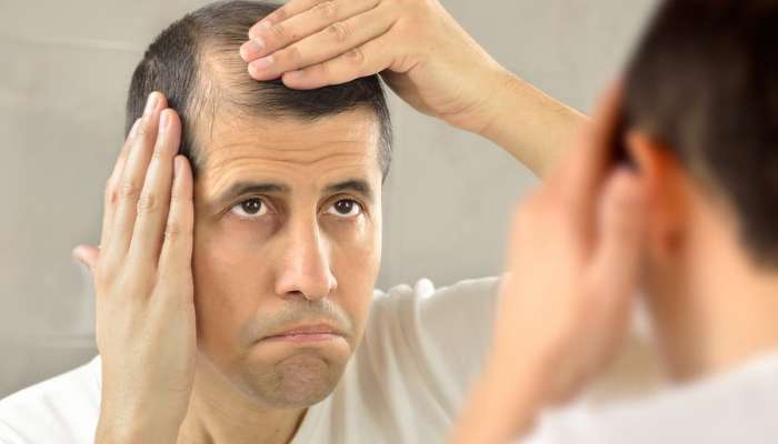 Juices For Hair: ટાલિયા બની જાવ તે પહેલાં પીવાનું શરૂ કરી દો આ 5 જ્યુસ, અટકી જશે ખરતા વાળ