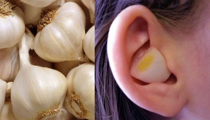 Ear Pain: કાનનો દુખાવો અને ખંજવાળ 10 મિનિટમાં દુર કરતાં સરળ ઘરેલુ ઉપાયો