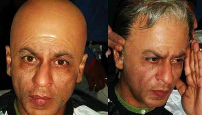 ક્યારેય ટકલા ના થવું હોય તો આ ઉપાય કર્યા સિવાય કોઈ છુટકો જ નથી! જરૂર વાંચો આ જાણકારી