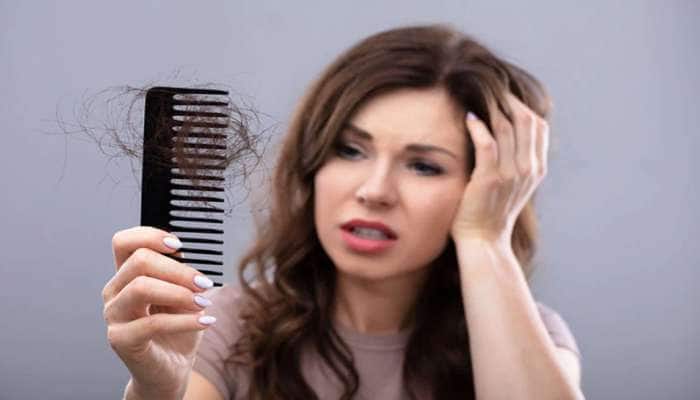 ખરતા વાળની સમસ્યાનું કાયમી સમાધાન છે આ ઘરગથ્થુ ઉપાય, 15 દિવસમાં વાળ ખરતા થશે બંધ