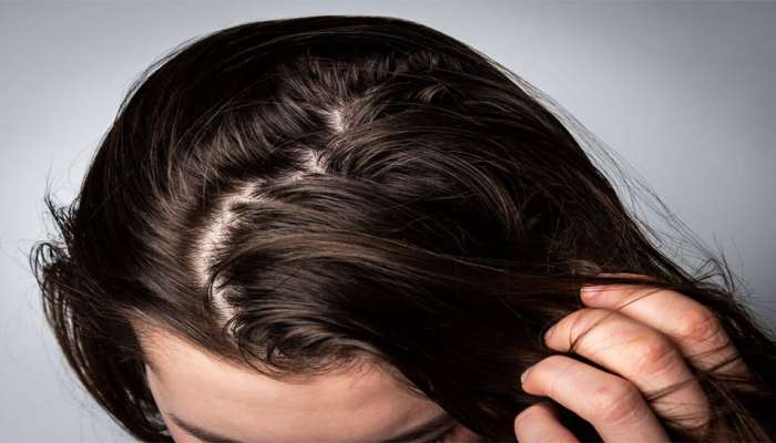 White Hair: સફેદ વાળ નેચરલી થવા લાગશે કાળા, રસોડાની આ 3 વસ્તુઓનો કરવાનો છે ઉપયોગ