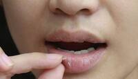 Lip Care: ફાટેલા હોઠ એક દિવસમાં બની જશે સોફ્ટ, દાદીમાના આ નુસખા ઝડપથી કરે છે અસર